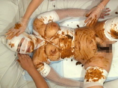 要脱糞介助女子に対する排泄介護例